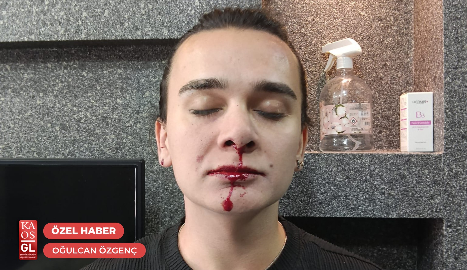Ankara’da homofobik saldırı: “Patronum gelmese beni öldürecekti” | Kaos GL - LGBTİ+ Haber Portalı Haber