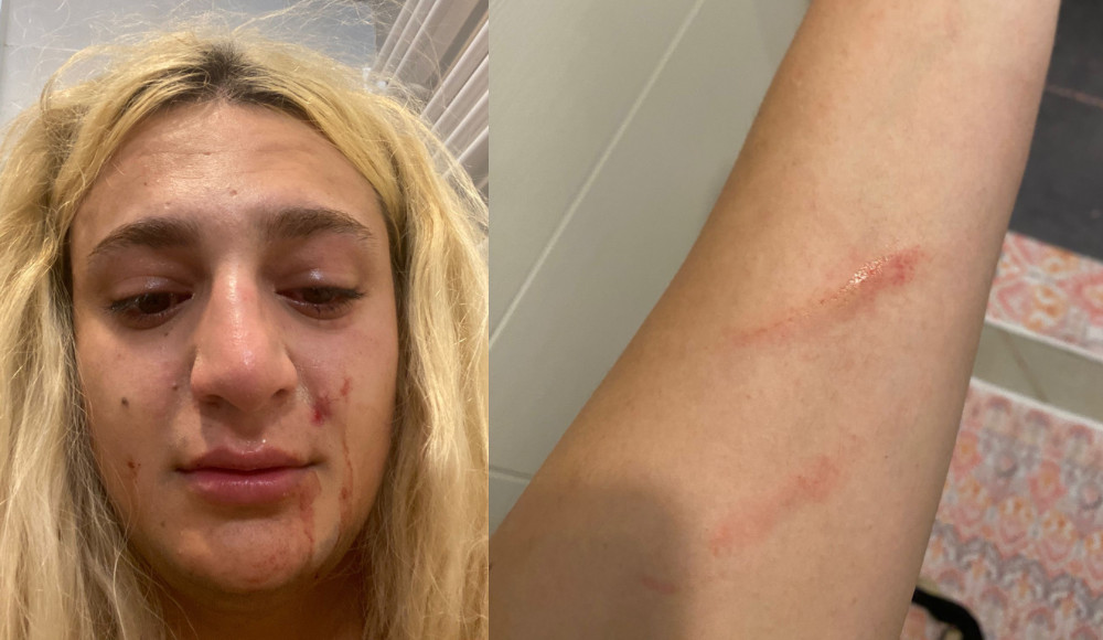 “Cinsiyet kimliğimden ötürü nefret saldırısına maruz bırakıldım, evden atıldım” Kaos GL - LGBTİ+ Haber Portalı