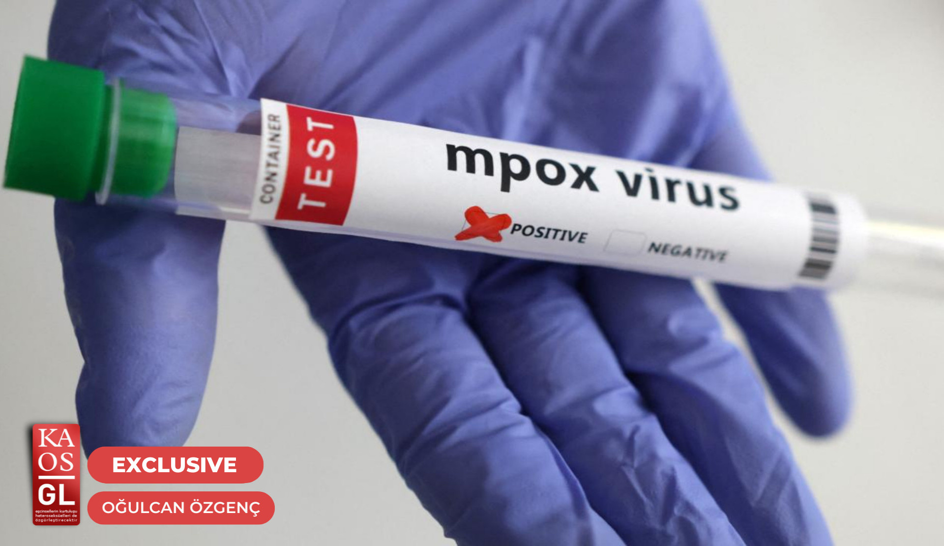 “Stigmatizing people with infectious diseases has been a problem for a long time” Kaos GL - News Portal for LGBTI+