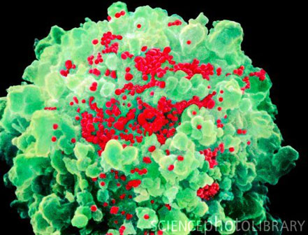 HIV/AIDS&rsquo;le Mücadelede Başarı | Kaos GL - LGBTİ+ Haber Portalı Haber