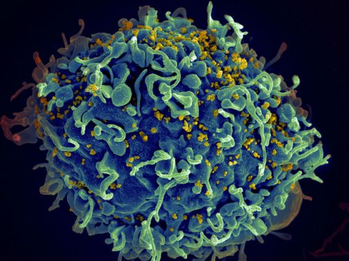 Tıpta Bir İlk: HIV Pozitif Bir Bebek Tedavi Edildi Kaos GL - LGBTİ+ Haber Portalı
