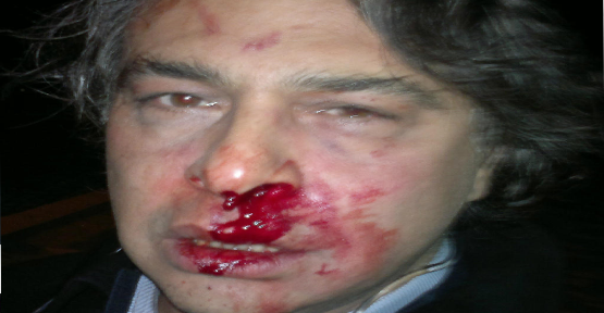 Attack to Fashion Designer Barbaros Şansal! Kaos GL - News Portal for LGBTI+