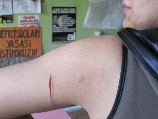 Transphobic Attacks in Maltepe will be protested Kaos GL - News Portal for LGBTI+