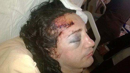 Transphobic Hate Crime in Mersin, Turkey Kaos GL - News Portal for LGBTI+