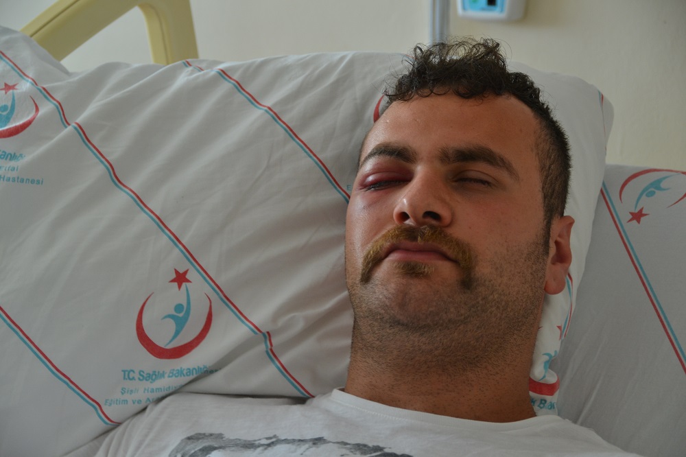 Vali yaralı yok dedi, Sinan tek gözünü kaybedebilir! Kaos GL - LGBTİ+ Haber Portalı